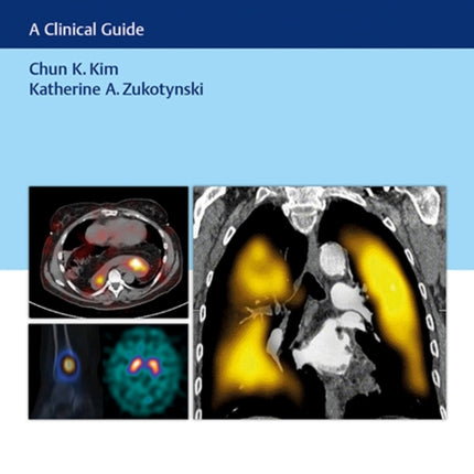 SPECT and SPECT/CT: A Clinical Guide