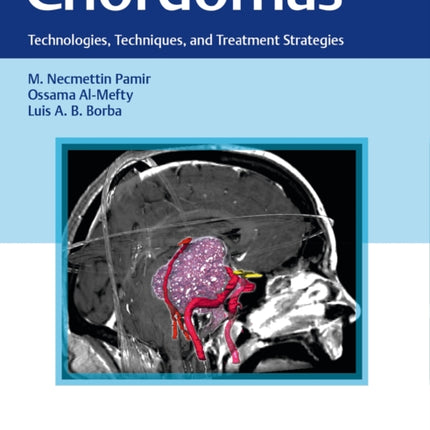 Chordomas: Technologies, Techniques, and Treatment Strategies