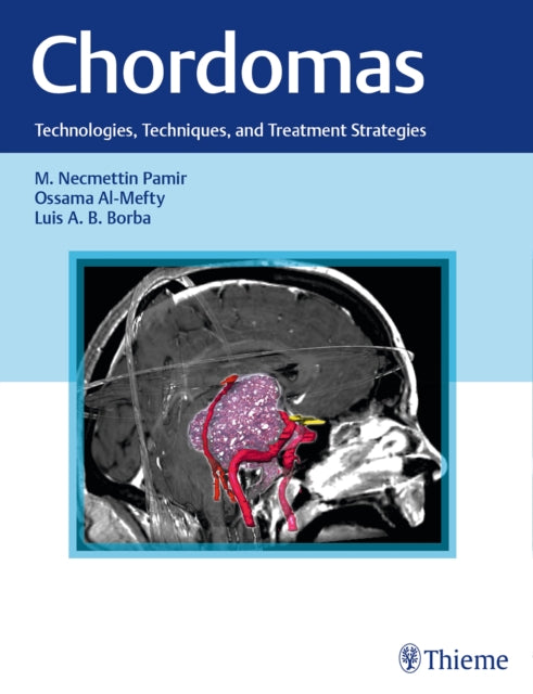 Chordomas: Technologies, Techniques, and Treatment Strategies