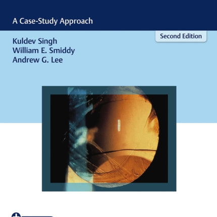 Ophthalmology Review