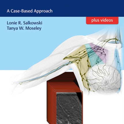 Clinical Breast Tomosynthesis: A Case-Based Approach