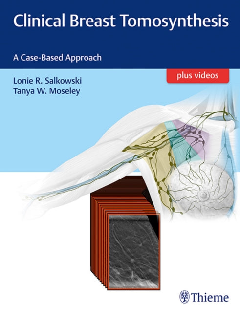 Clinical Breast Tomosynthesis: A Case-Based Approach