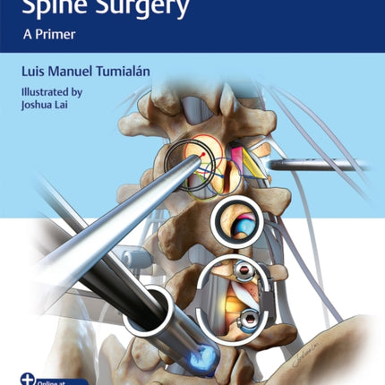 Minimally Invasive Spine Surgery