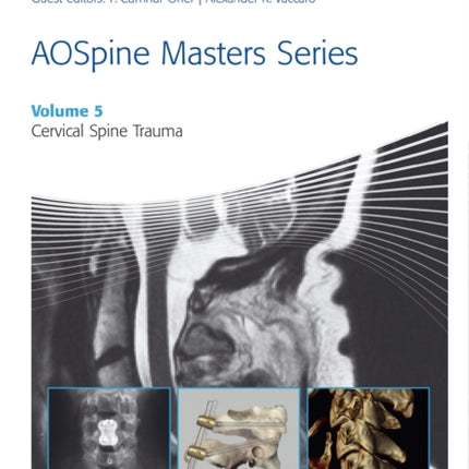 AOSpine Masters Series, Volume 5: Cervical Spine Trauma