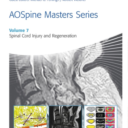 AOSpine Masters Series, Volume 7: Spinal Cord Injury and Regeneration