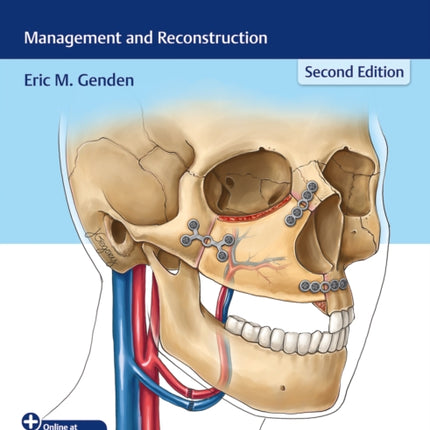 Head and Neck Cancer  Management and Reconstruction