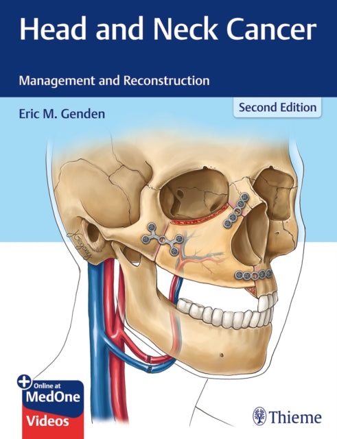 Head and Neck Cancer  Management and Reconstruction