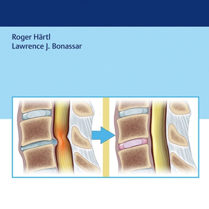 Biological Approaches to Spinal Disc Repair and Regeneration for Clinicians