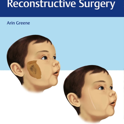 Pediatric Plastic and Reconstructive Surgery