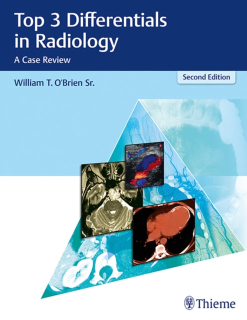 Top 3 Differentials in Radiology: A Case Review