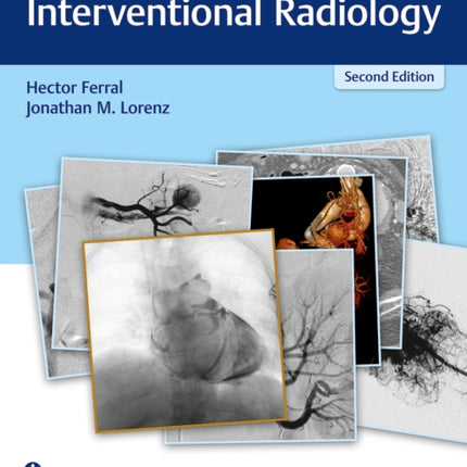 RadCases Q&A Interventional Radiology