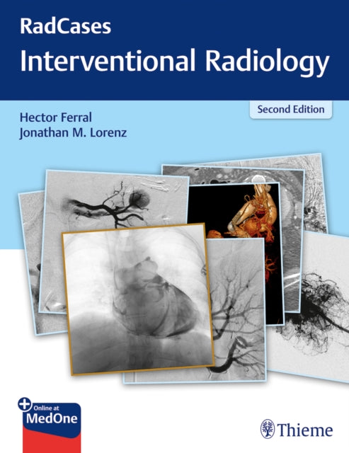 RadCases Q&A Interventional Radiology