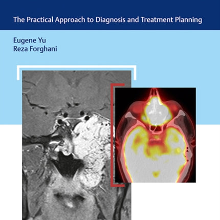 Skull Base Cancer Imaging: The Practical Approach to Diagnosis and Treatment Planning