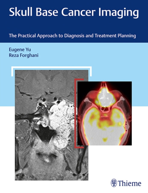 Skull Base Cancer Imaging: The Practical Approach to Diagnosis and Treatment Planning