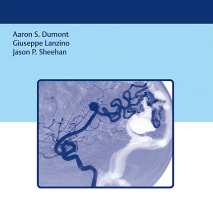 Brain Arteriovenous Malformations and Arteriovenous Fistulas