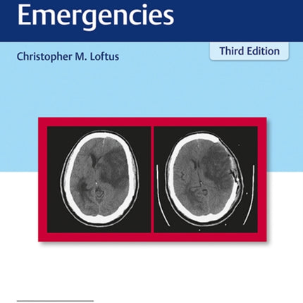 Neurosurgical Emergencies