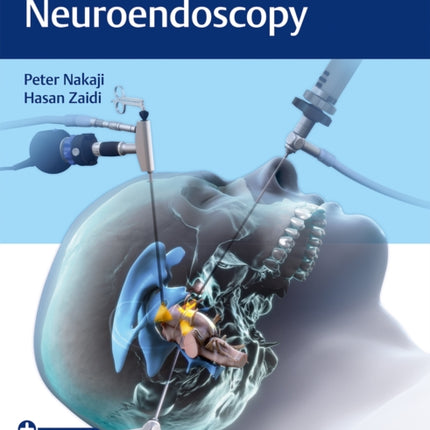 Controversies in Neuroendoscopy