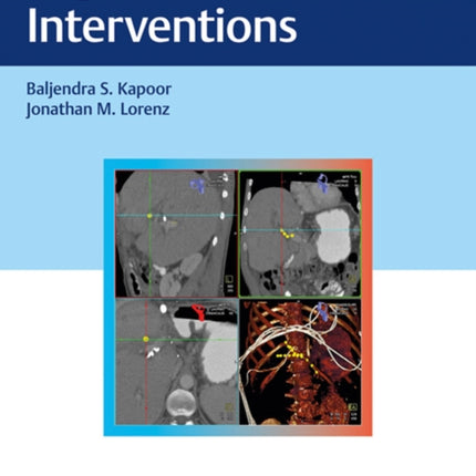 Digestive Disease Interventions