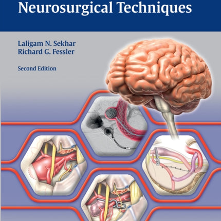 Atlas of Neurosurgical Techniques: Brain