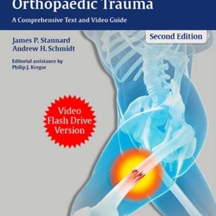 Surgical Treatment of Orthopaedic Trauma  A Comprehensive Text and Video Guide