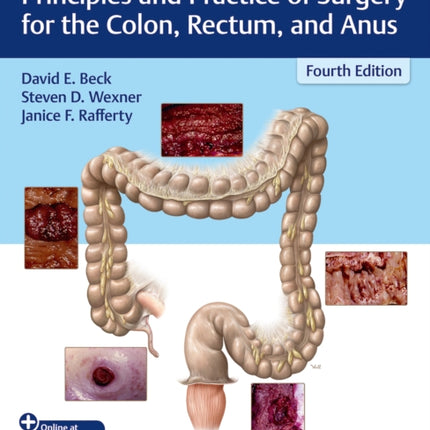 Gordon and Nivatvongs Principles and Practice of Surgery for the Colon Rectum and Anus