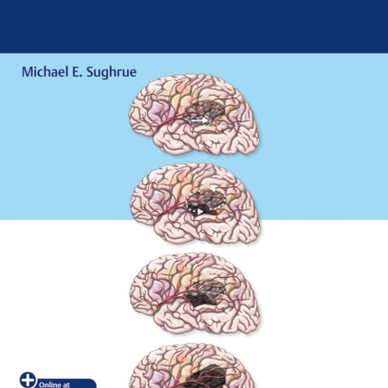 The Glioma Book