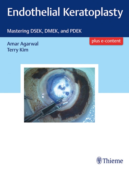 Endothelial Keratoplasty: Mastering DSEK, DMEK, and PDEK