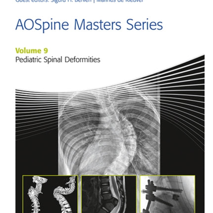 AOSpine Masters Series, Volume 9: Pediatric Spinal Deformities