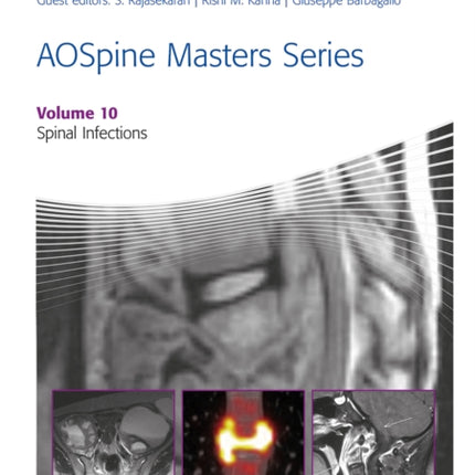 AOSpine Masters Series, Volume 10: Spinal Infections