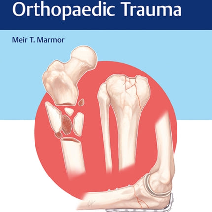 Decision Making in Orthopaedic Trauma