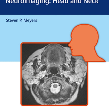 Differential Diagnosis in Neuroimaging: Head and Neck