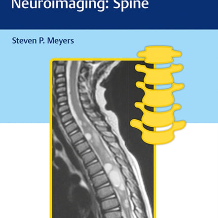 Differential Diagnosis in Neuroimaging: Spine