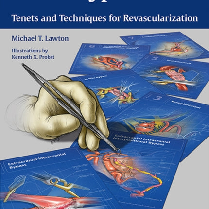 Seven Bypasses: Tenets and Techniques for Revascularization