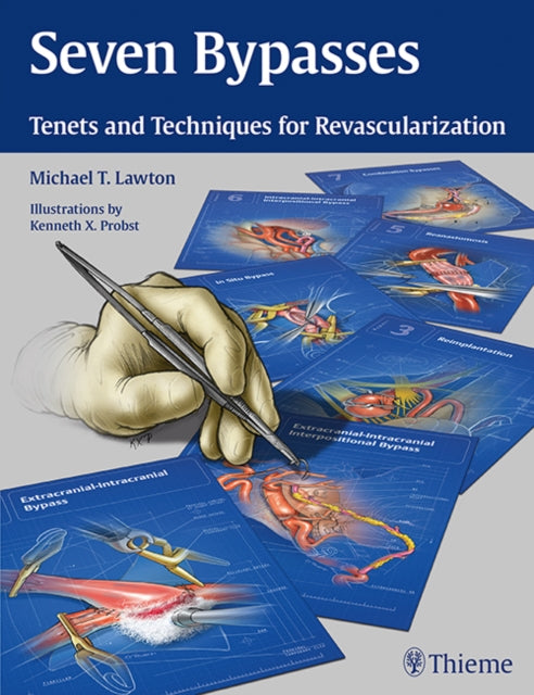 Seven Bypasses: Tenets and Techniques for Revascularization