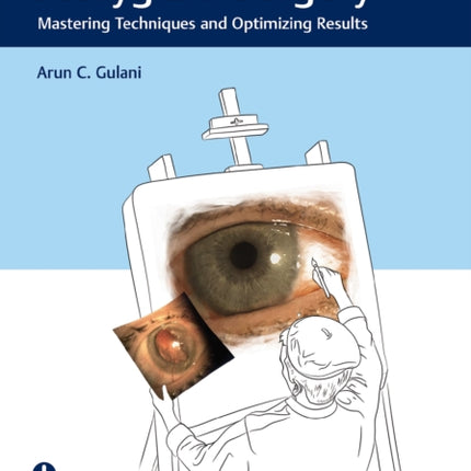 The Art of Pterygium Surgery