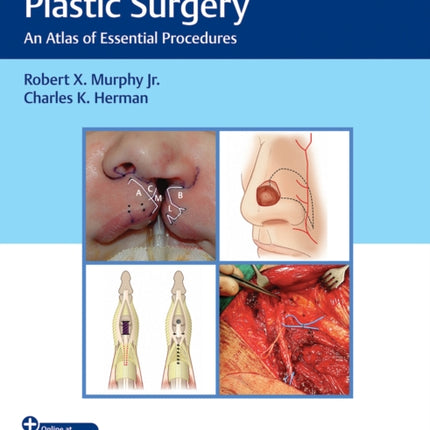 Reconstructive Plastic Surgery: An Atlas of Essential Procedures