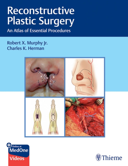 Reconstructive Plastic Surgery: An Atlas of Essential Procedures