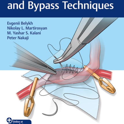 Microsurgical Basics and Bypass Techniques