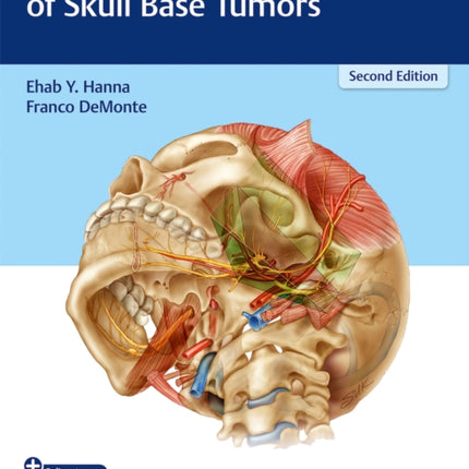 Comprehensive Management of Skull Base Tumors