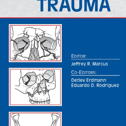 Essentials of Craniomaxillofacial Trauma