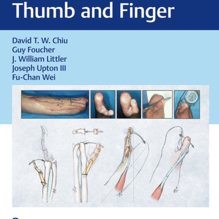 Reconstruction of the Thumb and Finger