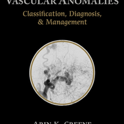 Vascular Anomalies: Classification, Diagnosis, and Management