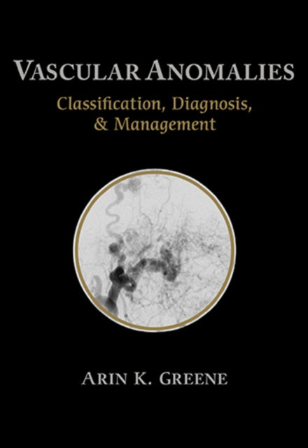 Vascular Anomalies: Classification, Diagnosis, and Management