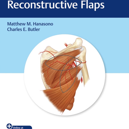 Handbook of Reconstructive Flaps