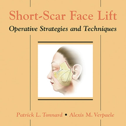 Short-Scar Face Lift: Operative Strategies and Techniques