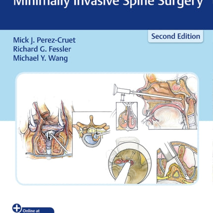 An Anatomic Approach to Minimally Invasive Spine Surgery