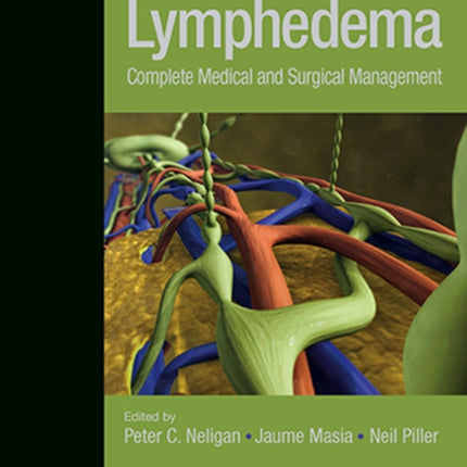 Lymphedema: Complete Medical and Surgical Management