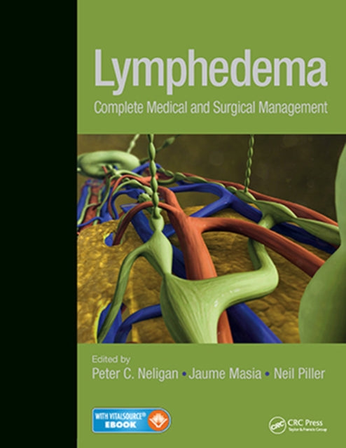 Lymphedema: Complete Medical and Surgical Management