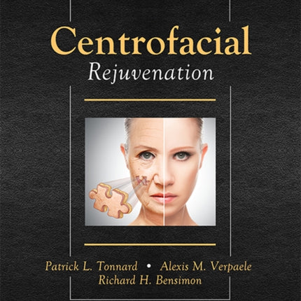 Centrofacial Rejuvenation