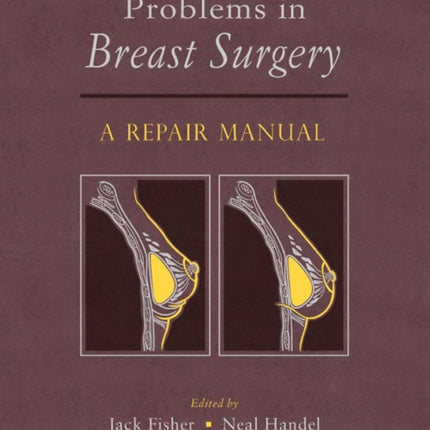 Problems in Breast Surgery